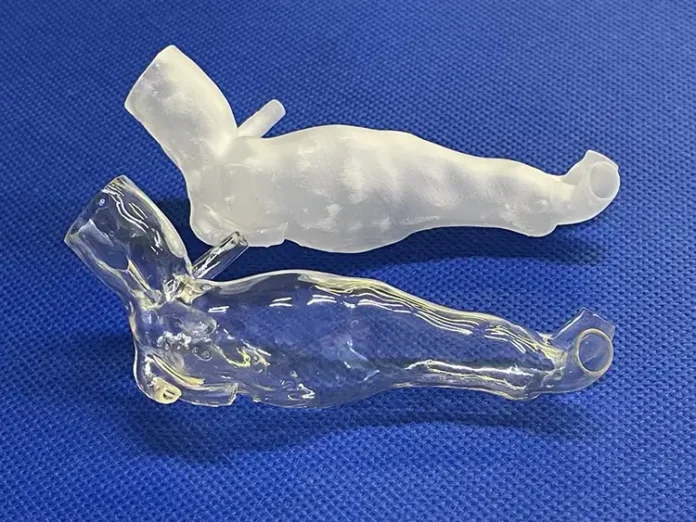 These patient-specific anatomical models represent an aneurysm in the abdominal part of the aorta, the main artery in the body. An uncoated model is shown at top and at bottom is a nearly-transparent thiol-ene-coated model.