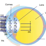 intraocular-filtering